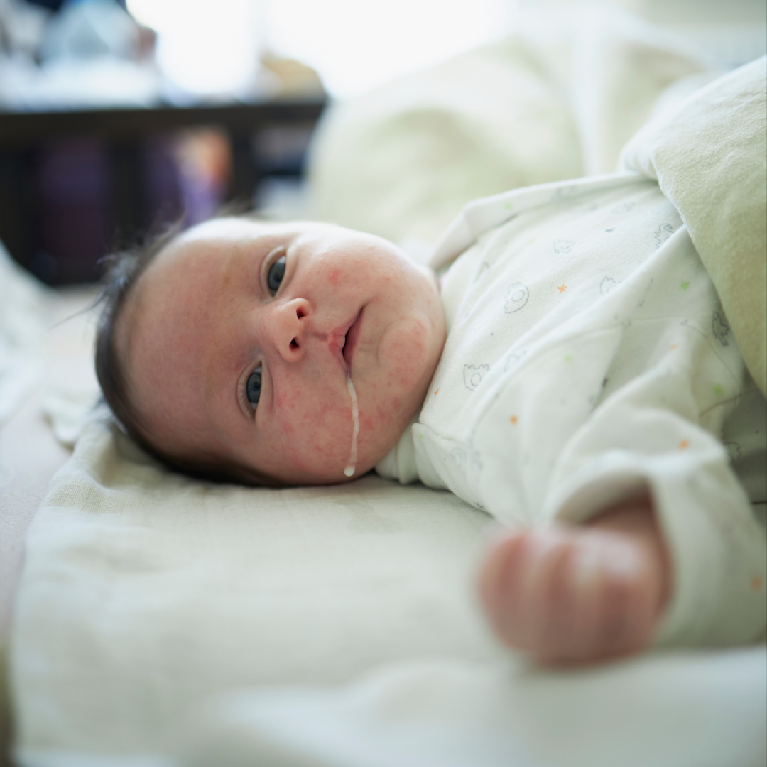 For Reflux & Spit-Up